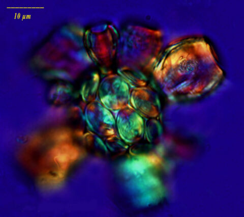 Coccolithophorids like this Scyphosphaera apsteinii incorporate carbon from their environment into plates that surround their bodies. Credit: NOAA Photo Library, courtesy of Dr. John R. Dolan, Laboratoire d'Oceanographique de Villefranche; Observatoire Oceanologique de Villefrance-sur-Mer , CC BY 2.0