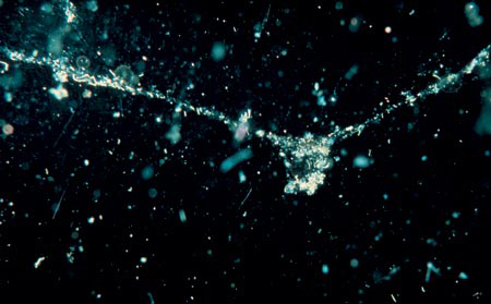 These bits and a web-like strand of “marine snow” were drifting 55 meters below the surface of the Monterey Bay in California. Credit: Photo courtesy of Susumu Honjo, Woods Hole Oceanographic Institution