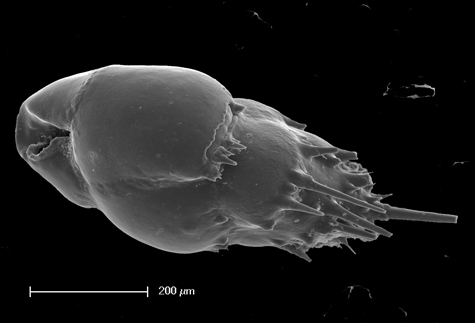 Scanning electron microscope image of Bulimina aculeata foraminifera.