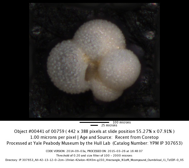 Microscopic image of a foram Microscopic image of a foram