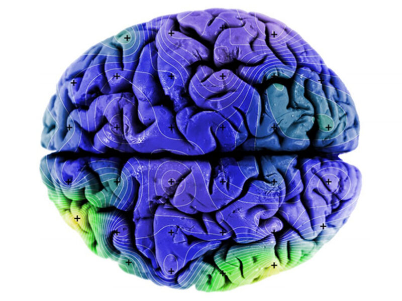 Human Brains Have Tiny Bits of Magnetic Material - Eos