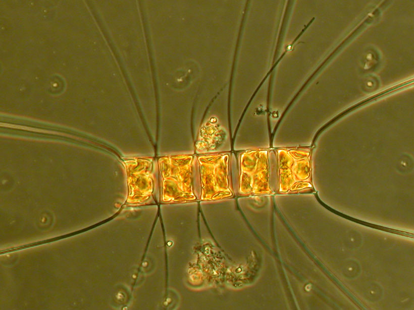 Microscopic image of a Chaetoceros large-cell diatom