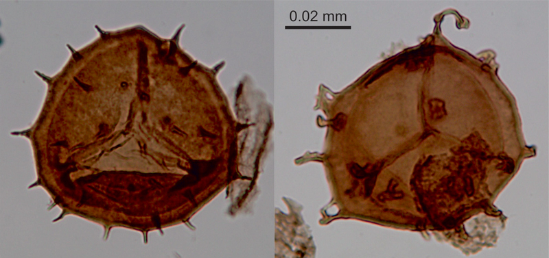 Normal and malformed spores from ancient fernlike plants