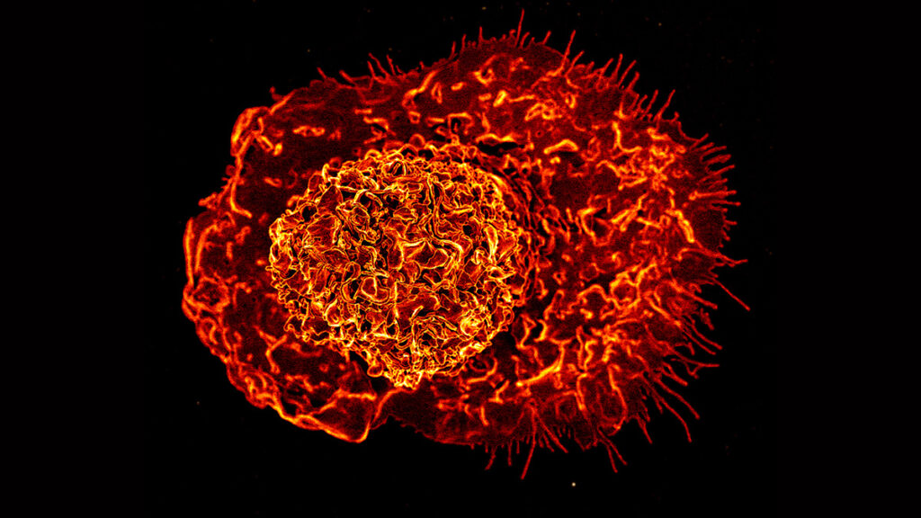 Colorized scanning electron micrograph of a macrophage