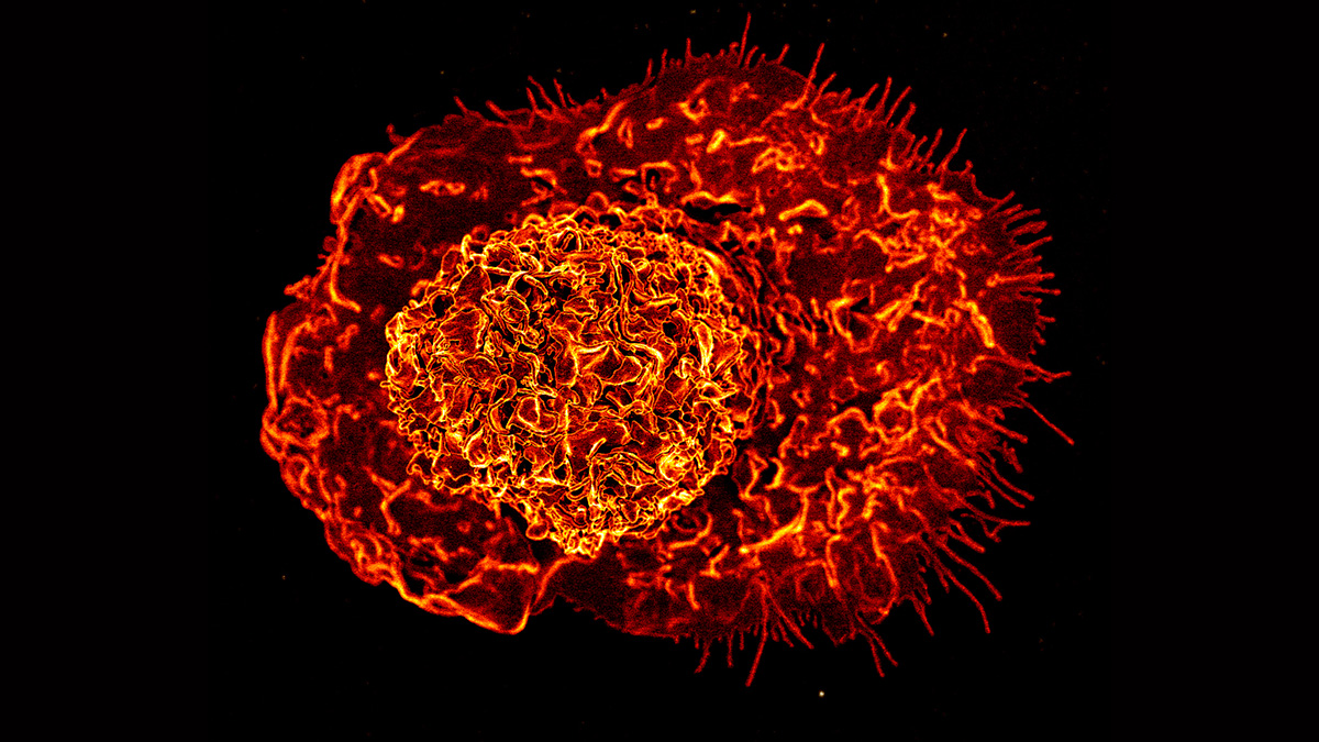 Colorized scanning electron micrograph of a macrophage