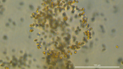 Microscopic image of a mucosphere with microbes trapped inside it.