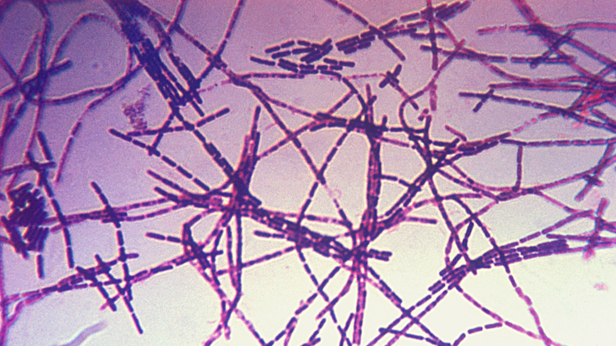 Photomicrograph of anthrax.