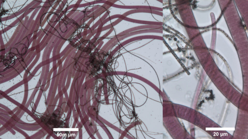 Two views of cyanobacterial filaments as seen under a microscope at different magnifications