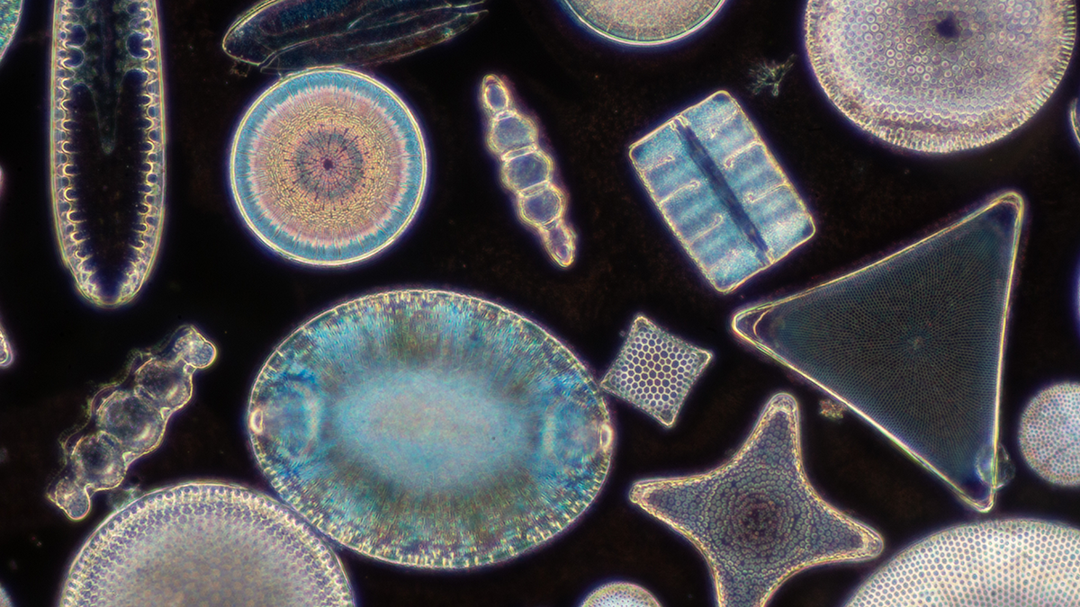 Microphotograph of diatoms of various shapes and sizes.