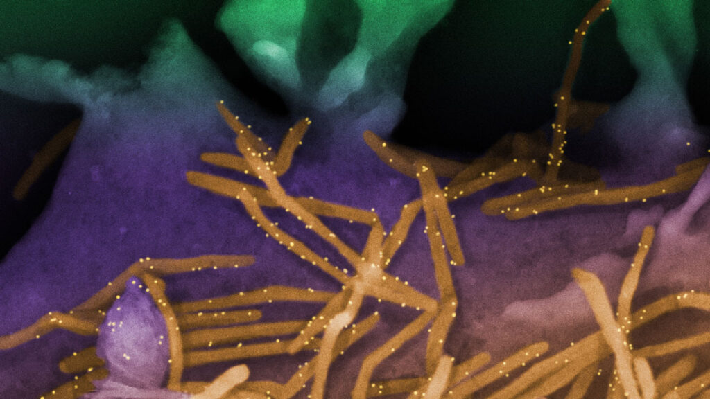 A colorized image of a virus as seen under a microscope, with purple and green in the background and long orange lines dotted with yellow specks.