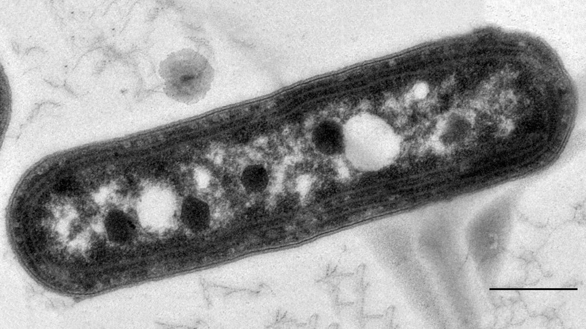 Image of a Synechococcus elongatus