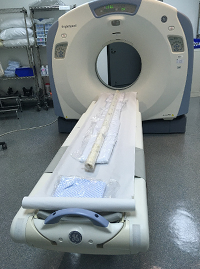 A coral core sits on the exam table of a computed tomography machine at a hospital.