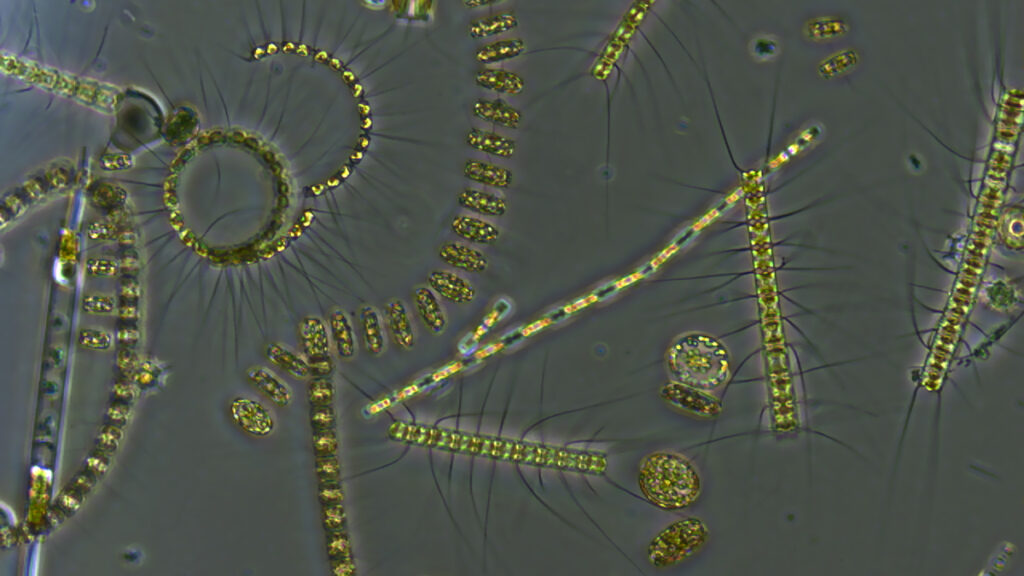 Against a gray background, strands of multicellular green organisms glow in artificial light.