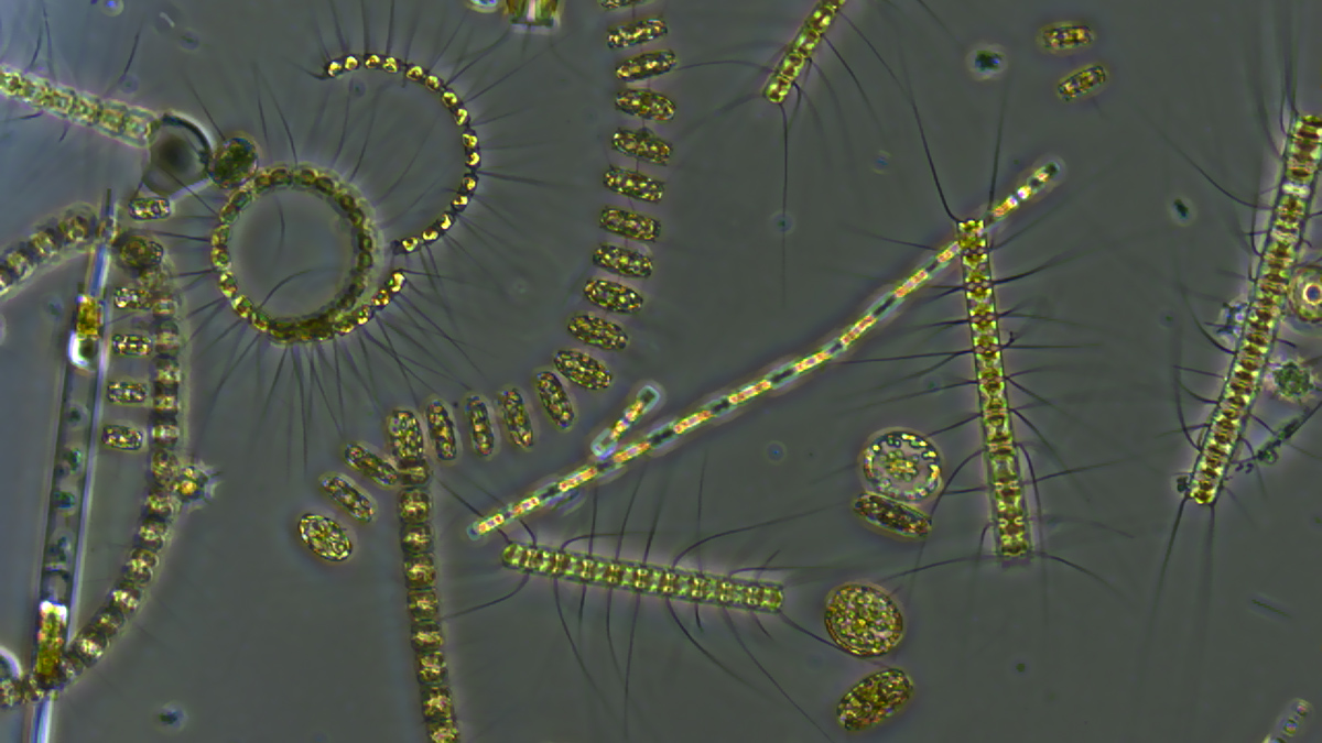 Against a gray background, strands of multicellular green organisms glow in artificial light.