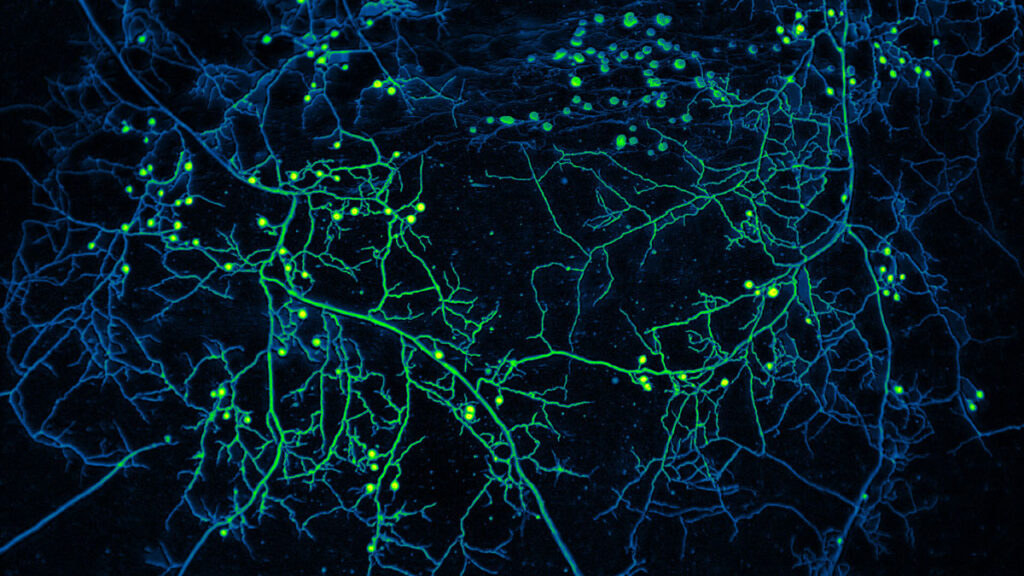 Tangled strands of mycorrhizal fungi with an appearance similar to plant roots.