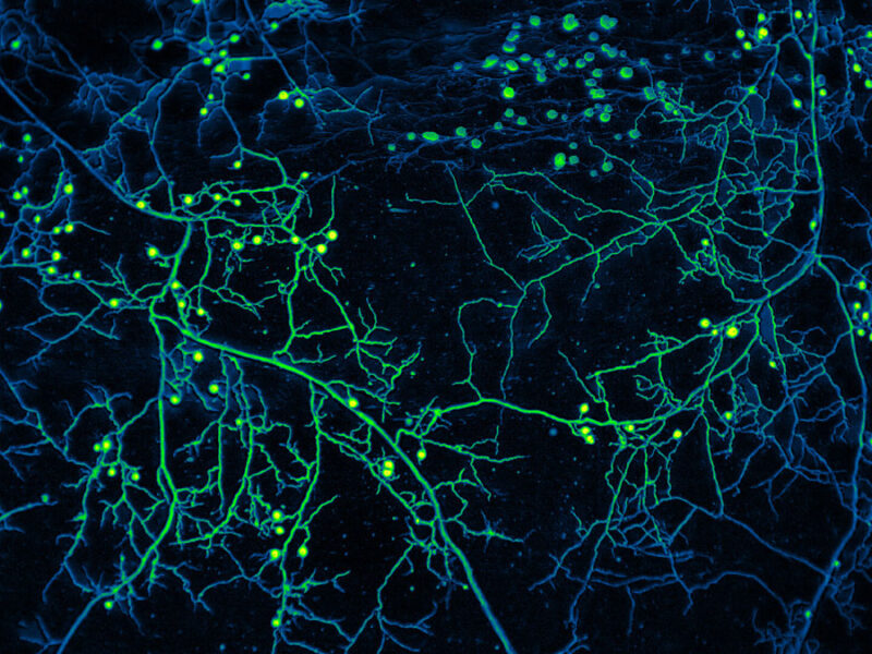 How Plant-Fungi Friendships Are Changing