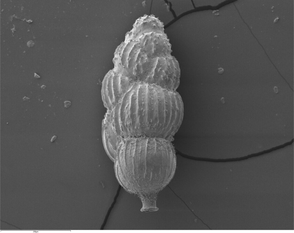A grayscale microscopic image of the shell of a microorganism.