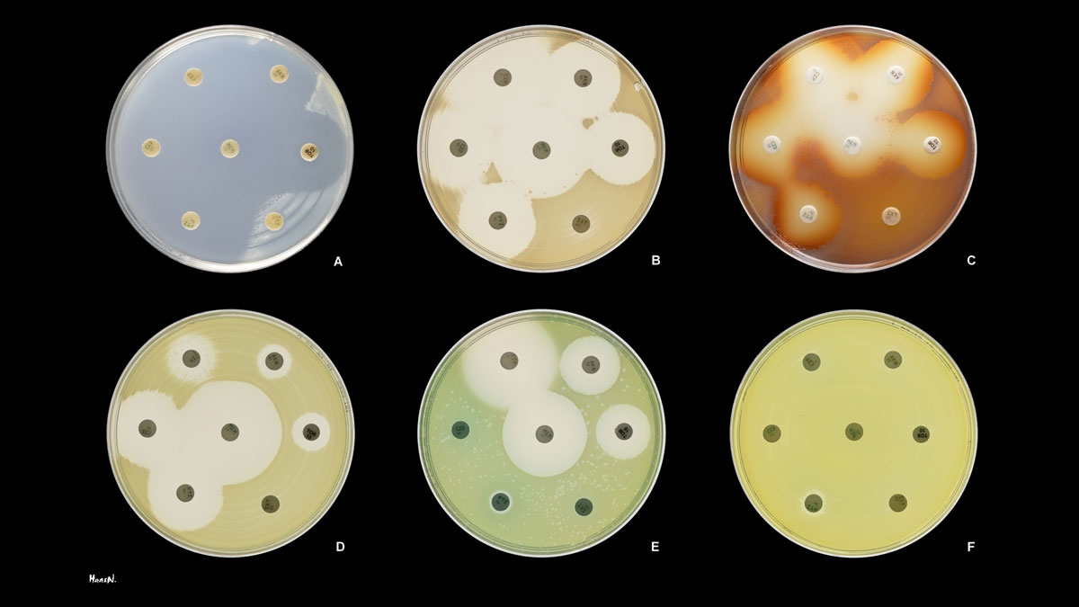 Six circles, labeled A through F, each with seven dots on them. In some of the circles, the dots are surrounded by circles of their own, showing how the dots (antibiotics) are affecting the bacteria in the dish.