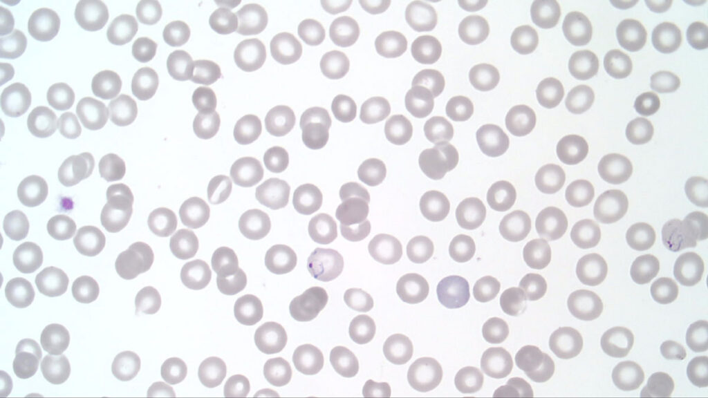 An image under a microscope shows dozens of pale purple circles against a white background.