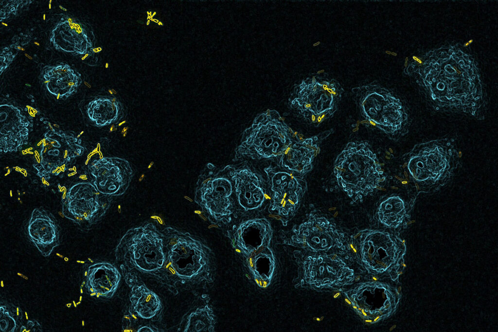 An image from under a microscope shows a series of blue blobs (lung cells), some flecked with smaller, tubular yellow objects (<em>Pseudomonas aeruginosa bacteria</em>).