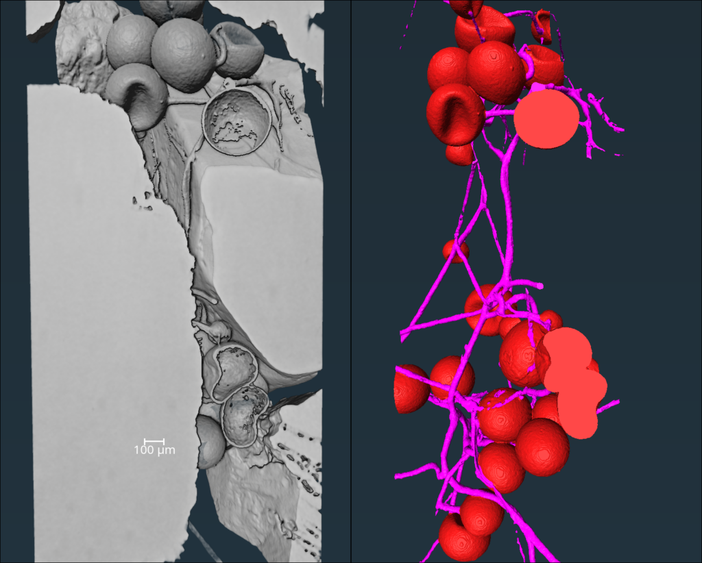 Two images of the same network of hyphae, represented by long threads, and fungi spores, represented by approximate spheres. On the left, part of the image is blocked out with swaths of gray. On the right, more is visible, and the hyphae are pink, and the fungi spores are red.